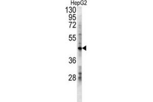 Western Blotting (WB) image for anti-Lactate Dehydrogenase D (LDHD) antibody (ABIN3002427) (LDHD antibody)