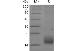 Western Blotting (WB) image for Tumor Necrosis Factor Receptor Superfamily, Member 17 (TNFRSF17) protein (His tag) (ABIN7321028)