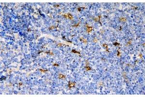 IHC analysis of CCR6 using anti-CCR6 antibody (ABIN7603110). (CCR6 antibody  (N-Term))