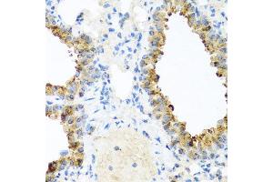 Immunohistochemistry of paraffin-embedded mouse lung using NIN antibody at dilution of 1:100 (x40 lens).