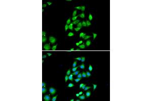Immunofluorescence analysis of HeLa cells using NFS1 antibody (ABIN6130224, ABIN6144594, ABIN6144596 and ABIN6217361). (NFS1 antibody  (AA 208-457))