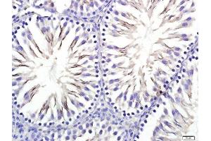 Paraformaldehyde-fixed, paraffin embedded Rat testis tissue, Antigen retrieval by boiling in sodium citrate buffer(pH6) for 15min, Block endogenous peroxidase by 3% hydrogen peroxide for 20 minutes, Blocking buffer (normal goat serum) at 37°C for 30min, Antibody incubation with STIL Polyclonal Antibody, Unconjugated  at 1:400 overnight at 4°C, followed by a conjugated secondary and DAB staining (STIL antibody)