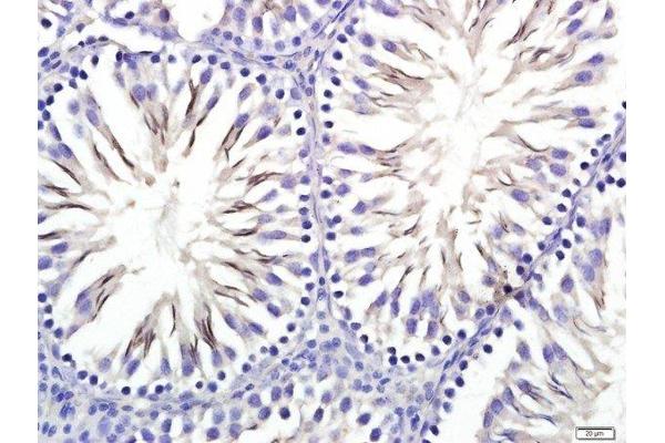 STIL antibody