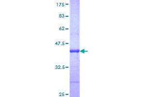 ABCA4 Protein (AA 2174-2273) (GST tag)