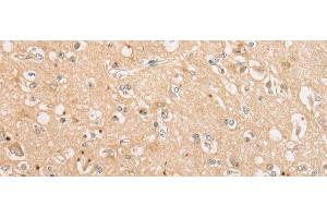 Immunohistochemistry of paraffin-embedded Human brain tissue using C15orf40 Polyclonal Antibody at dilution of 1:30(x200) (C15orf40 antibody)