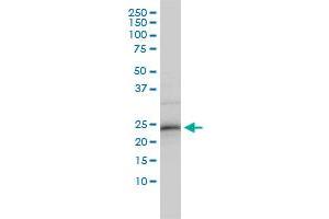 ZNF313 monoclonal antibody (M01), clone 4G3-1A10 Western Blot analysis of ZNF313 expression in HepG2 . (RNF114 antibody  (AA 1-228))