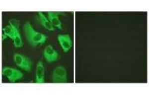 Immunofluorescence analysis of HeLa cells, using Kir5. (KIR5.1 antibody)