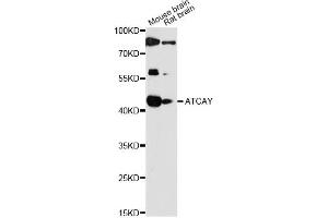 Western blot analysis of extracts of various cell lines, using ATCAY antibody (ABIN6292798) at 1:1000 dilution.