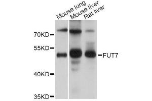 Western blot analysis of extracts of various cell lines, using FUT7 Antibody (ABIN5995907) at 1/1000 dilution. (FUT7 antibody)