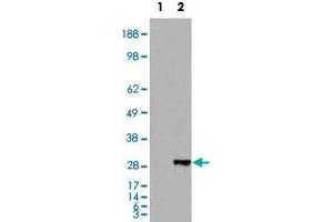HEK293 overexpressing BDH2 and probed with BDH2 polyclonal antibody  (mock transfection in first lane), tested by Origene. (BDH2 antibody  (Internal Region))