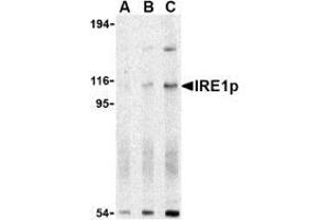 Western blot analysis of IRE1p in A-20 cell lysate with AP30445PU-N IRE1p antibody at (A) 0. (ERN1 antibody  (N-Term))