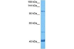 Host:  Mouse  Target Name:  KIF23  Sample Tissue:  Mouse Spleen  Antibody Dilution:  1ug/ml