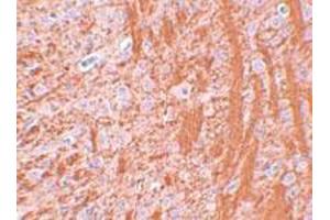 Immunohistochemical staining of rat brain tissue with 2. (JMJD6 antibody  (N-Term))
