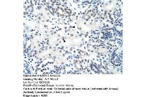 Rabbit Anti-HNRPH3 Antibody  Paraffin Embedded Tissue: Human Kidney Cellular Data: Epithelial cells of renal tubule Antibody Concentration: 4. (HNRNPH3 antibody  (N-Term))