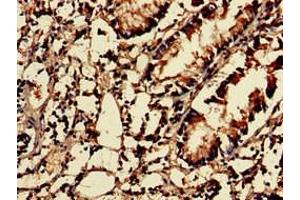 Immunohistochemistry of paraffin-embedded human appendix tissue using ABIN7142858 at dilution of 1:100