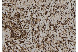 ABIN6277757 at 1/100 staining Human gastric tissue by IHC-P. (PVALB antibody  (C-Term))