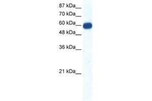 Western Blotting (WB) image for anti-Solute Carrier Family 18 (Vesicular Monoamine Transporter), Member 1 (SLC18A1) antibody (ABIN2461184) (SLC18A1 antibody)