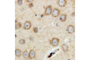 Immunohistochemical analysis of RIMS4 staining in human brain formalin fixed paraffin embedded tissue section. (RIMS4 antibody)