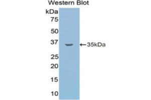 Detection of Recombinant LSR, Human using Monoclonal Antibody to Lipolysis Stimulated Lipoprotein Receptor (LSR) (LSR antibody  (AA 335-589))