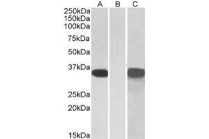 HEK293 lysate (10ug protein in RIPA buffer) overexpressing Human CRISP2 (ABIN5410871) with C-terminal MYC tag probed with ABIN571121 (1ug/ml) in Lane A and probed with anti-MYC Tag (1/1000) in lane C.