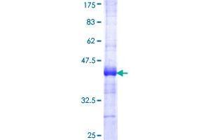 Acetyl-CoA Carboxylase alpha Protein (ACACA) (AA 1-99) (GST tag)