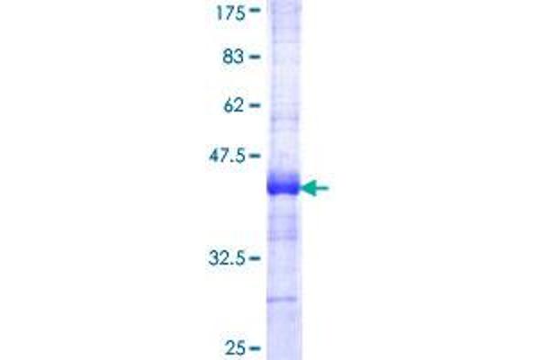 Acetyl-CoA Carboxylase alpha Protein (ACACA) (AA 1-99) (GST tag)
