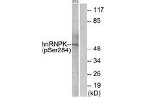 Western blot analysis of extracts from NIH-3T3 cells treated with EGF 200ng/ml 30', using hnRNP K (Phospho-Ser284) Antibody. (HNRNPK antibody  (pSer284))