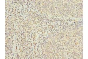 Immunohistochemistry of paraffin-embedded human tonsil tissue using ABIN7159116 at dilution of 1:100 (MED18 antibody  (AA 35-208))