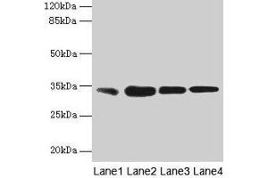 Western blot All lanes: RAD23A antibody at 3 μg/mL Lane 1: MCF-7 whole cell lysate Lane 2: Hela whole cell lysate Lane 3: Raji whole cell lysate Lane 4: Jurkat whole cell lysate Secondary Goat polyclonal to rabbit IgG at 1/10000 dilution Predicted band size: 40, 34 kDa Observed band size: 34 kDa (RAD23A antibody  (AA 2-201))