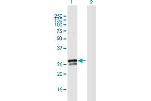Western Blot analysis of RAB3B expression in transfected 293T cell line by RAB3B MaxPab polyclonal antibody. (RAB3B antibody  (AA 1-219))