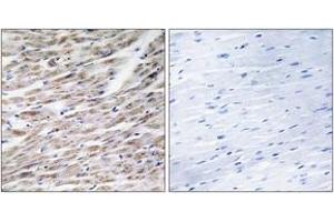 Immunohistochemistry (IHC) image for anti-Granzyme A (Granzyme 1, Cytotoxic T-Lymphocyte-Associated serine Esterase 3) (GZMA) (AA 61-110) antibody (ABIN1534446)