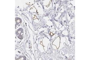 Immunohistochemical staining of human breast with C19orf12 polyclonal antibody  shows strong positivity in adipocytes at 1:50-1:200 dilution. (C19ORF12 antibody)