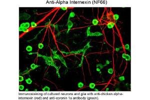 Immunohistochemistry of Anti-Alpha Internexin (chicken) Antibody - 200-901-D04 Immunohistochemistry of Anti-Alpha Internexin (chicken) Antibody. (INA antibody)