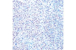 Immunohistochemistry of paraffin-embedded rat spleen using SNRPB Rabbit pAb (ABIN6134519, ABIN6148214, ABIN6148215 and ABIN6219175) at dilution of 1:100 (40x lens). (SNRPB antibody  (AA 1-100))