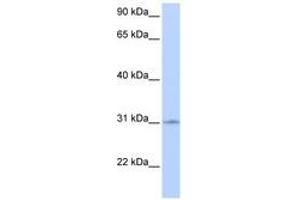 Image no. 1 for anti-Zinc Finger Protein 146 (ZNF146) (AA 144-193) antibody (ABIN6740512) (ZNF146 antibody  (AA 144-193))