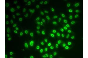 Immunofluorescence analysis of MCF7 cell using SNRPD1 antibody.