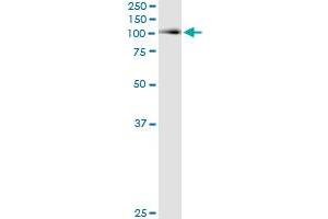 Immunoprecipitation of ACO1 transfected lysate using anti-ACO1 monoclonal antibody and Protein A Magnetic Bead , and immunoblotted with ACO1 MaxPab rabbit polyclonal antibody. (Aconitase 1 antibody  (AA 780-889))