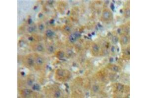 #VALUE! (GDF10 antibody  (AA 339-477))