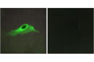 Immunofluorescence analysis of HeLa cells, using COL4A5 antibody. (COL4a5 antibody  (N-Term))