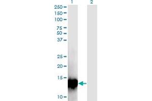 Western Blot analysis of C17orf37 expression in transfected 293T cell line by C17orf37 monoclonal antibody (M09), clone 4D4. (C17orf37 antibody  (AA 1-115))