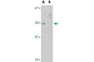 Western blot analysis of AKIRIN2 in human brain tissue lysate with AKIRIN2 polyclonal antibody  at 0. (AKIRIN2 antibody  (Internal Region))
