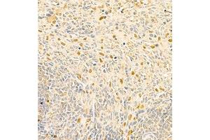 Immunohistochemistry of paraffin embedded rat spleen using RAPGEF5 (ABIN7075365) at dilution of 1:700 (400x lens)
