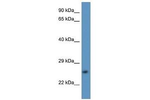 Western Blot showing CAPNS2 antibody used at a concentration of 1. (CAPNS2 antibody  (N-Term))