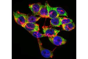 Immunocytochemistry (ICC) image for anti-Lipoprotein (Lp(a)) (AA 4330-4521) antibody (ABIN1845714) (Lp(a) antibody  (AA 4330-4521))