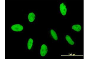 Immunofluorescence of purified MaxPab antibody to GTF2IRD2 on HeLa cell. (GTF2IRD2 antibody  (AA 1-498))