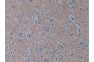 Detection of SIRPa in Human Cerebrum Tissue using Polyclonal Antibody to Signal Regulatory Protein Alpha (SIRPa) (SIRPA antibody  (AA 105-324))