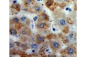 Used in DAB staining on fromalin fixed paraffin-embedded Liver tissue (Motilin antibody  (AA 25-112))