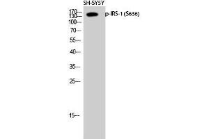 Western Blot (WB) analysis of SH-SY5Y cells using Phospho-IRS-1 (S636) Polyclonal Antibody. (IRS1 antibody  (pSer636))