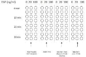 Image no. 1 for Signal Transducer and Activator of Transcription 6, Interleukin-4 Induced (STAT6) ELISA Kit (ABIN1981845)