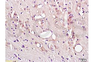Formalin-fixed and paraffin embedded rat brain tissue labeled with Anti-CD54/ICAM-1 Polyclonal Antibody (ABIN670806), Unconjugated at 1:200, followed by conjugation to the secondary antibody and DAB staining